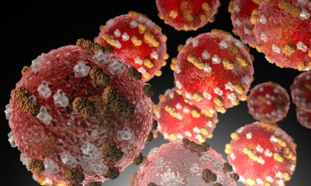 Measles case confirmed in Anchorage